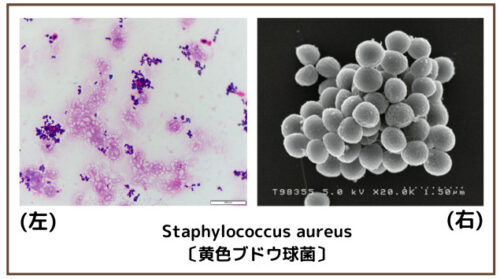 Staphylococcus aureus〔黄色ブドウ球菌〕