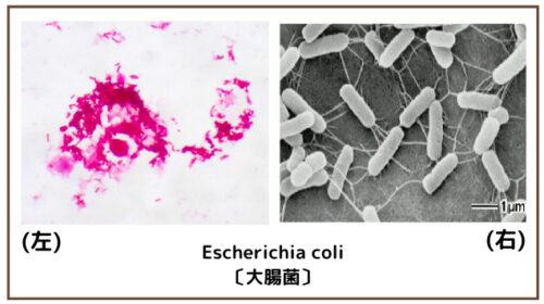 Escherichia coli〔大腸菌〕