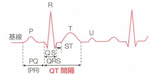 心電図の基本波形