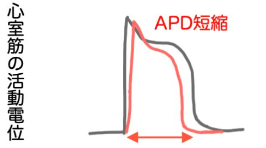 活動電位持続時間の短縮メカニズム